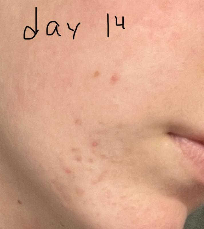 Customer photo for "It works okay"