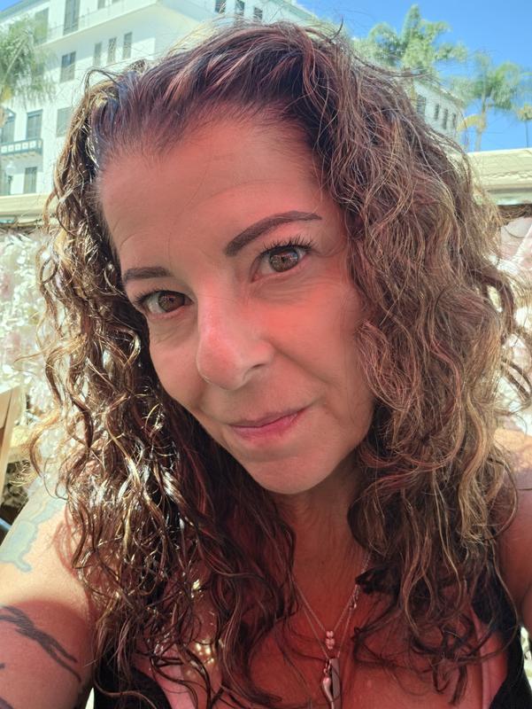 Customer photo for "So soothing after accidental sunburn"