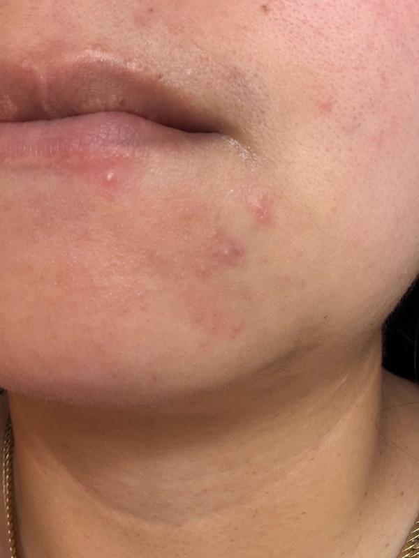 Review Thumbnail Image 0 383114751