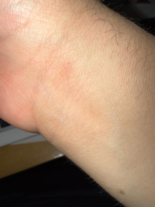 Review Thumbnail Image 0 382578292