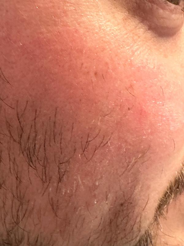 Review Thumbnail Image 1 383464486