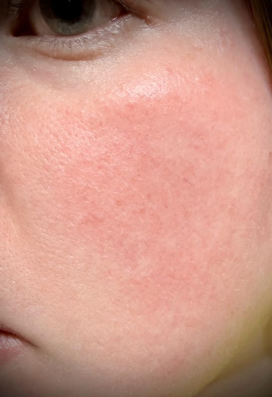 Review Thumbnail Image 2 379497834