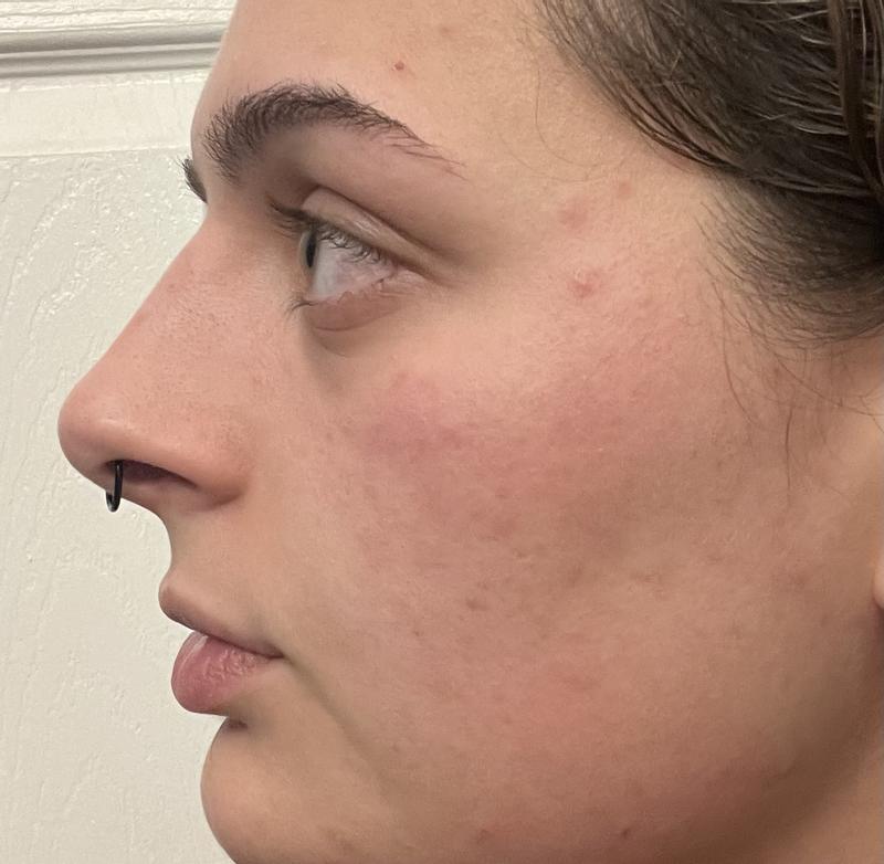 After cleansing, serum, eye cream, moisturizer.