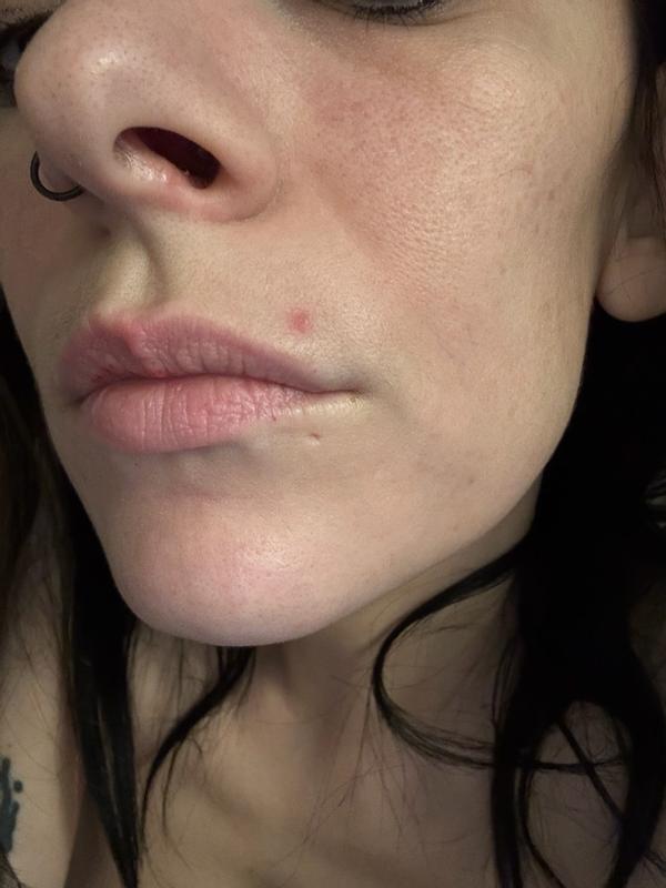 Review Thumbnail Image 0 381588517