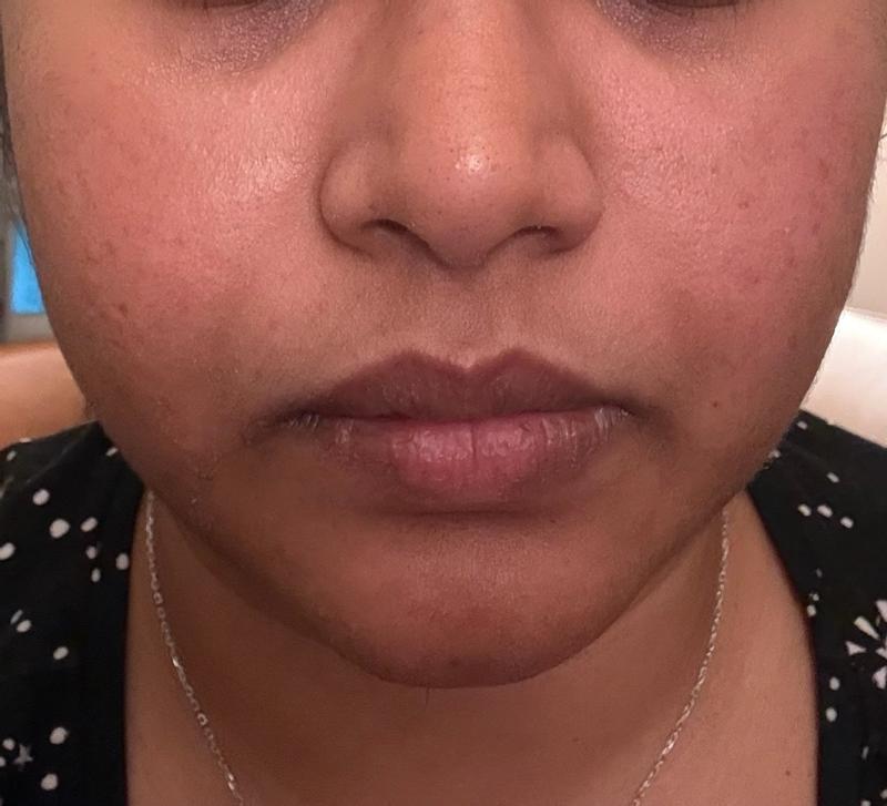 Review Thumbnail Image 1 382055299