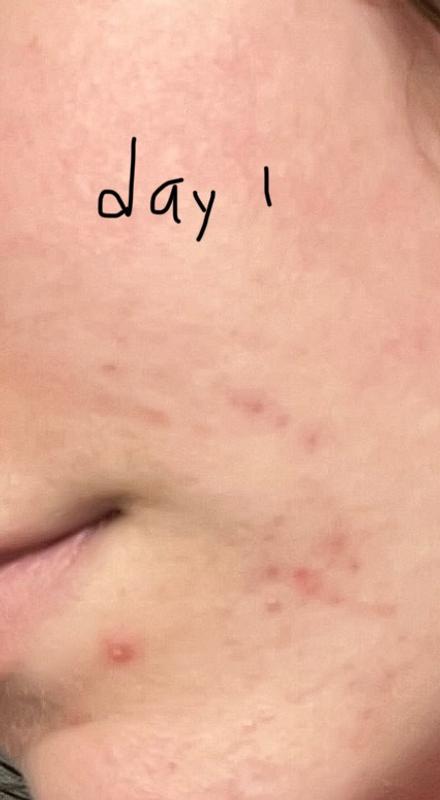 Customer photo for "It works okay"