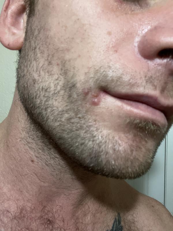 Breakout from one use.