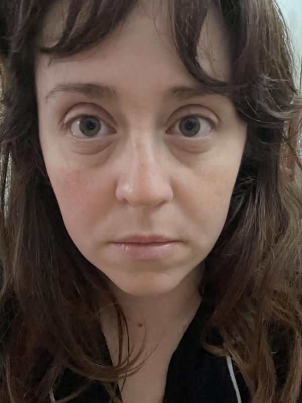 I’ve never had puffy eyes in my life