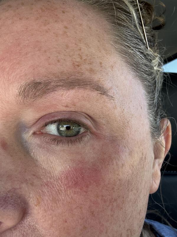 Review Thumbnail Image 0 384044945