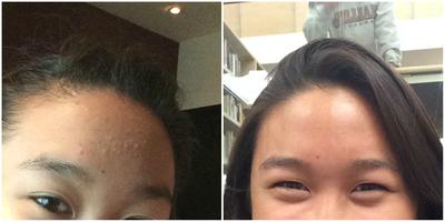 Before and After
