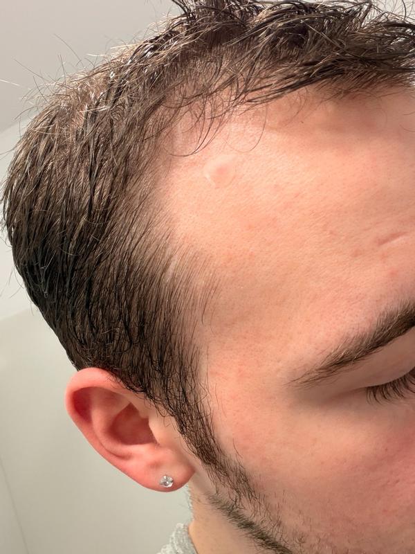 Review Thumbnail Image 2 382672839