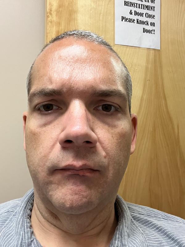 Still oily and shiny