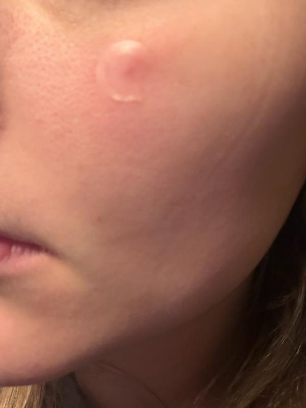 Review Thumbnail Image 1 383161371