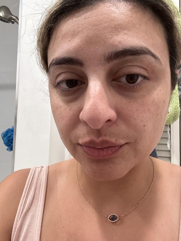 Right after treatment