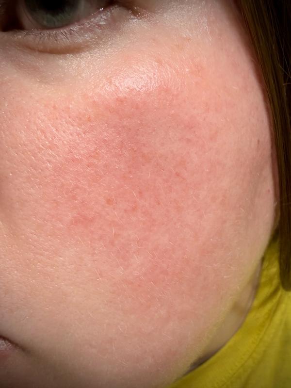 Review Thumbnail Image 1 379497834