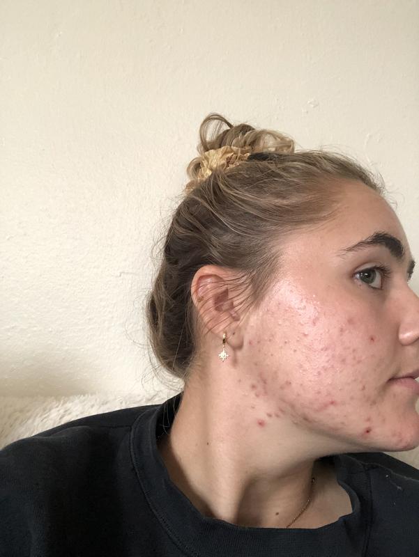 Major breakout from spf