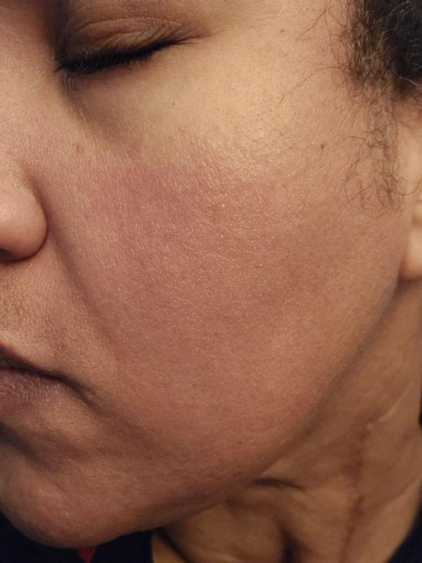 Review Thumbnail Image 1 383280120