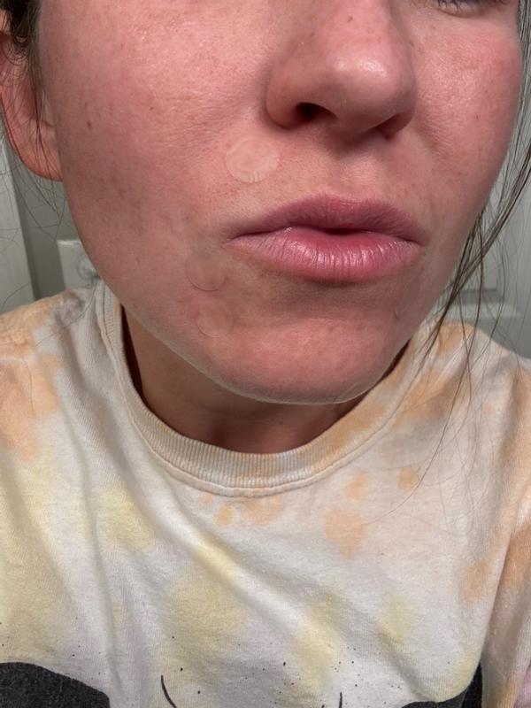 Customer carousel item 10.