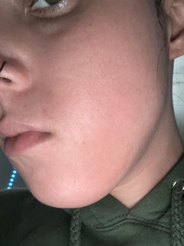 This is just after applying