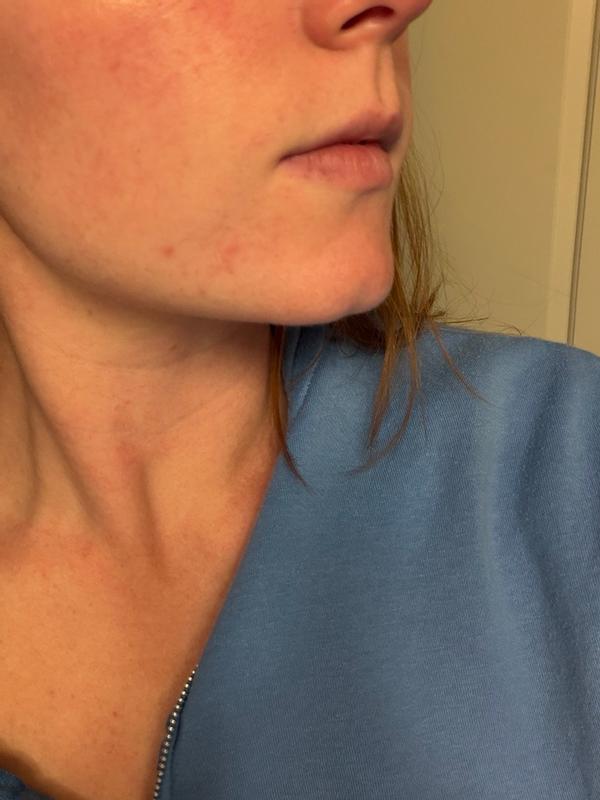 Review Thumbnail Image 0 383167529