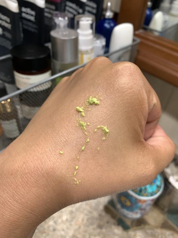 Customer photo for "This Product Definitely Solved My Skin Concerns!"