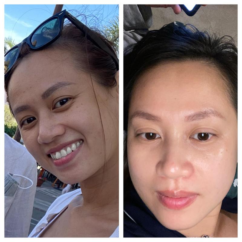 My skin 2 years ago and my new skin