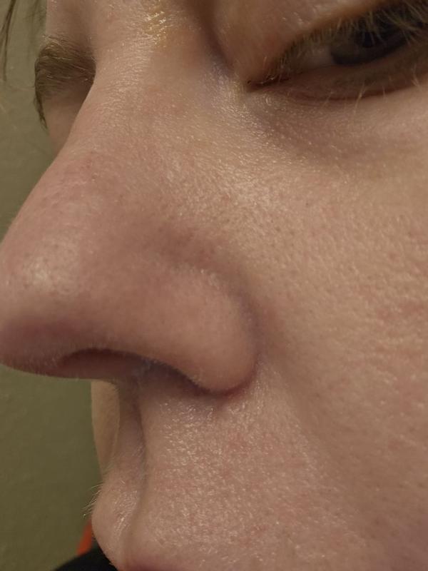 Review Thumbnail Image 1 380393772