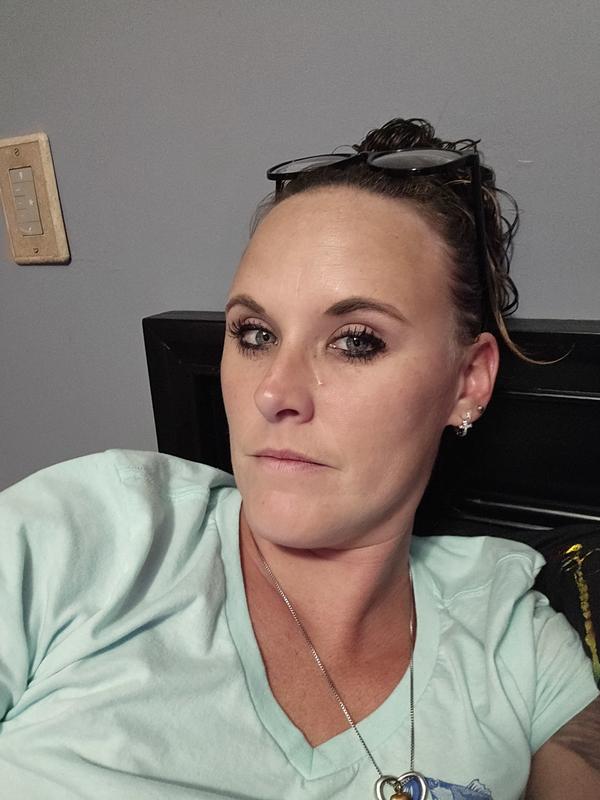 Before with sad skin