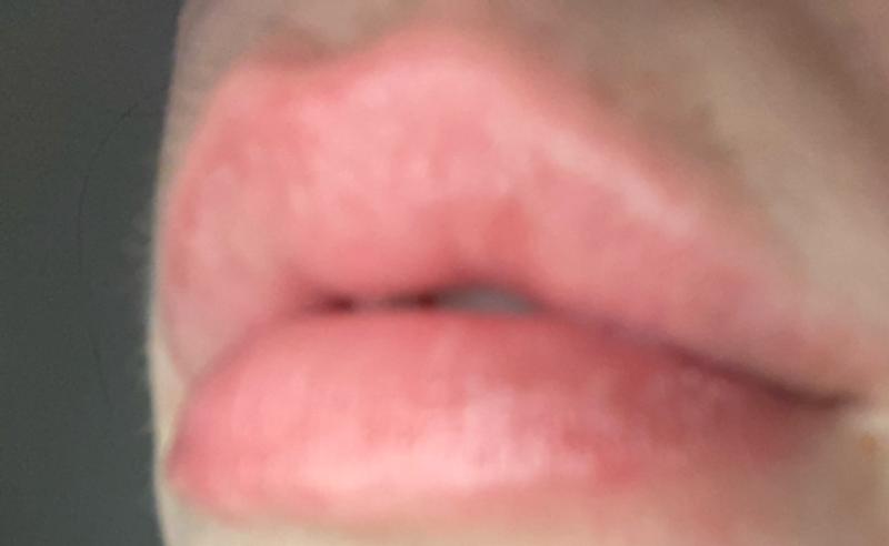 Lips are always thirsty 😭