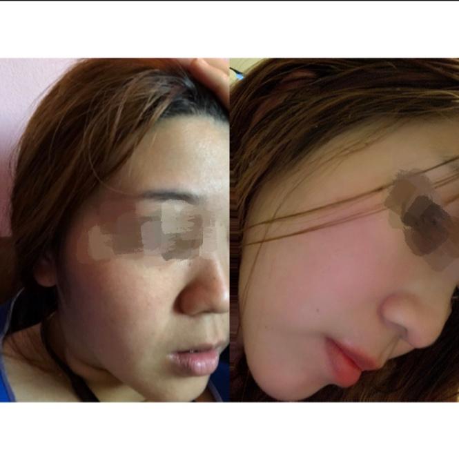 kiehl's clearly corrective dark spot solution