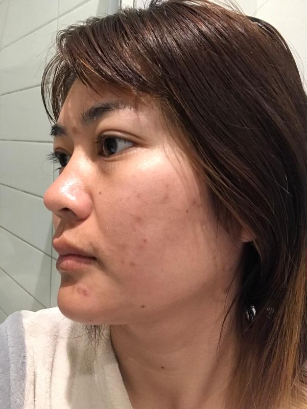 After 1 week