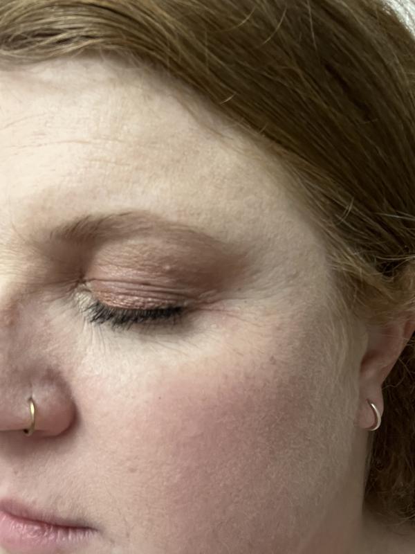 Review Thumbnail Image 4 266092515