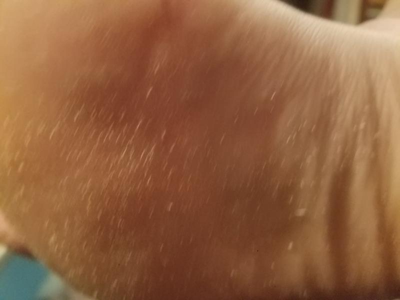 Pumice exfoliates the skin nicely!