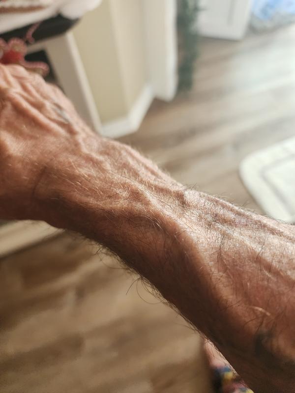 Great vascularity at 60 years old