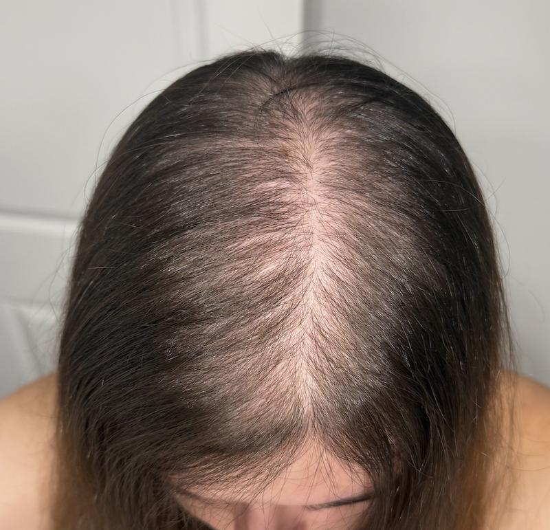 Review Thumbnail Image 0 386214521