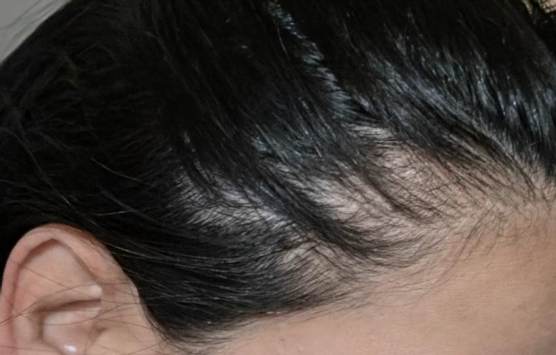 Customer photo for "Thrilled with this headband."
