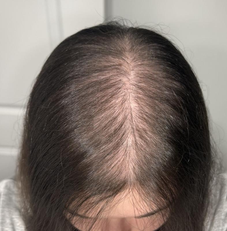 Review Thumbnail Image 1 386214521