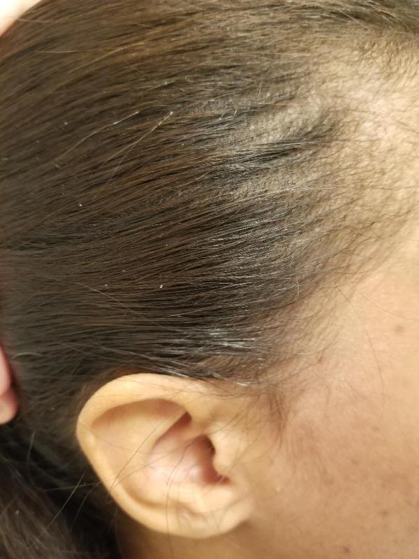 AFTER! Can you see the difference?