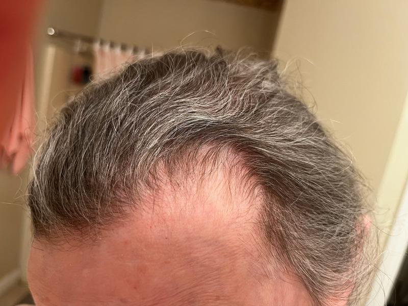 Customer photo for "Hello, New Hair!"