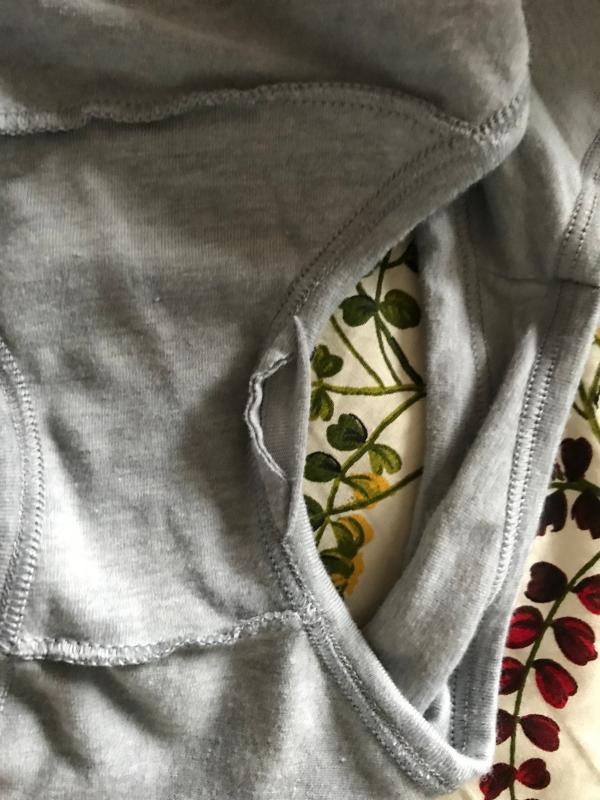 Leg band came undone.