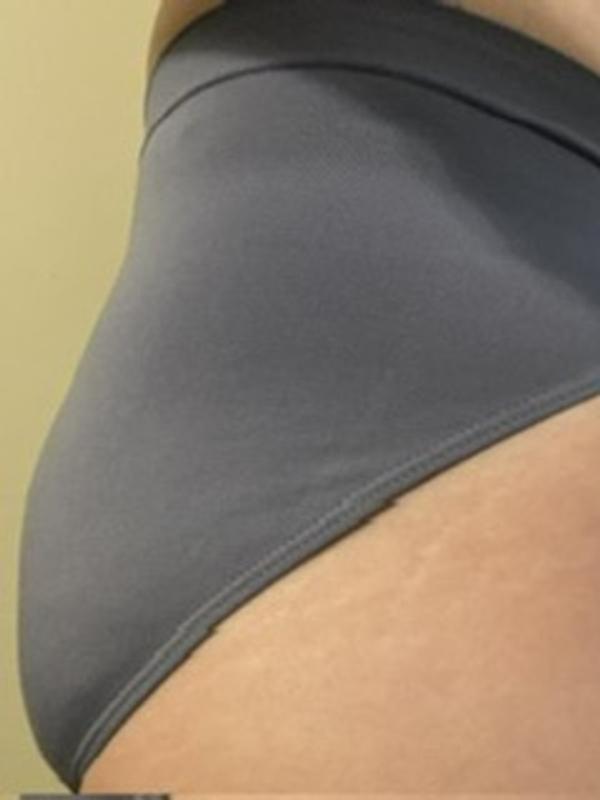 Seams can show through tight clothes!! 😦🙁