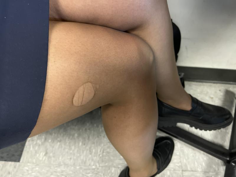 Day 1 I don’t know where and how it happened