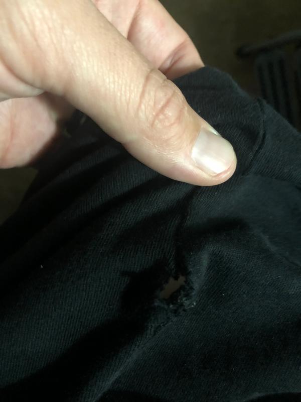 No longer itchy, just sporting a hole!