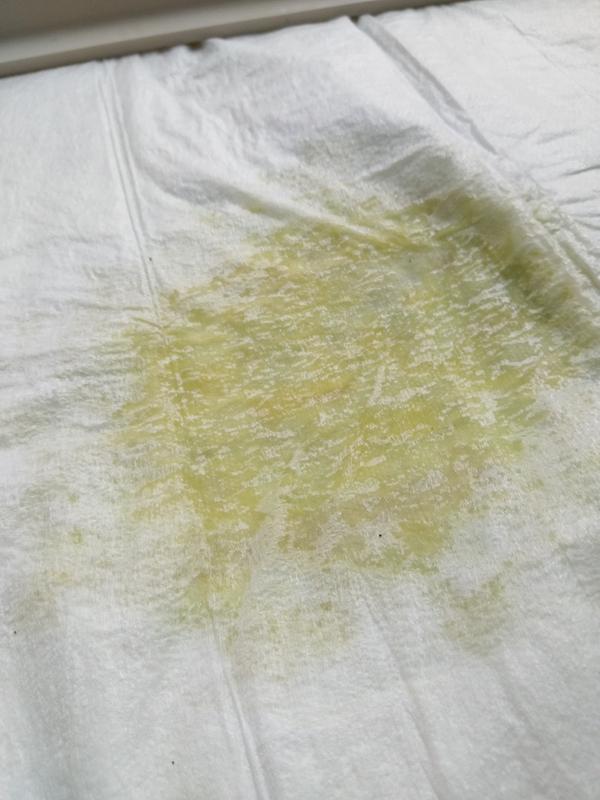 Urine spot after 45 minutes