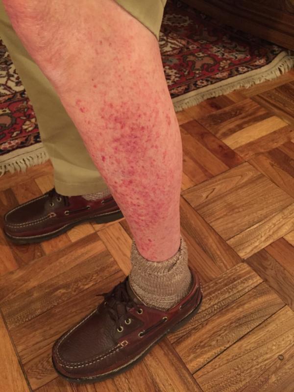 Photo submitted with review of product