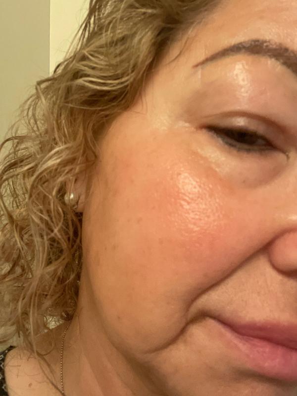 Customer photo for "Marvelous Oil for dry skin"