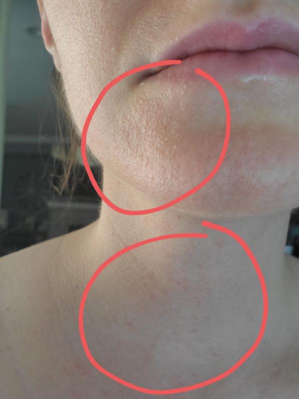 Customer photo for "Broke out in a rash!"