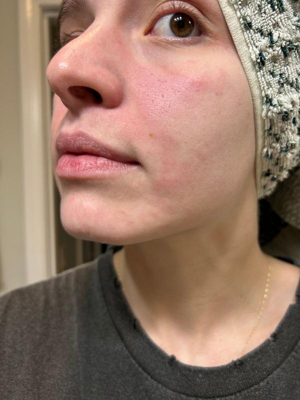 Customer photo for "o no"