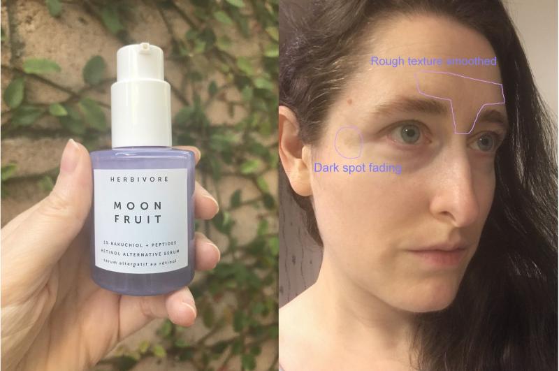 Customer photo for "Faded dark spot + smoothed rough texture! Sensitive skin approved"