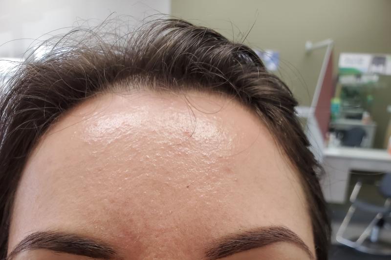 Customer photo for "Broke out in a rash!"